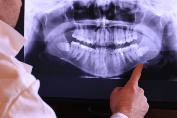Best Emergency Denture Repair in Marion, TX